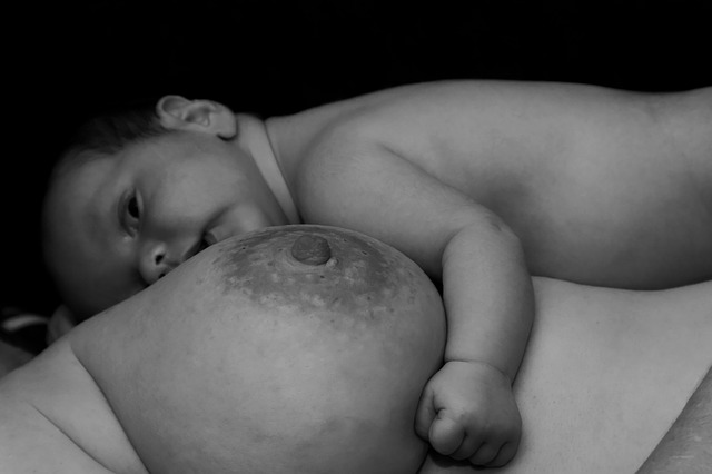 breast abnormalities breastfeeding